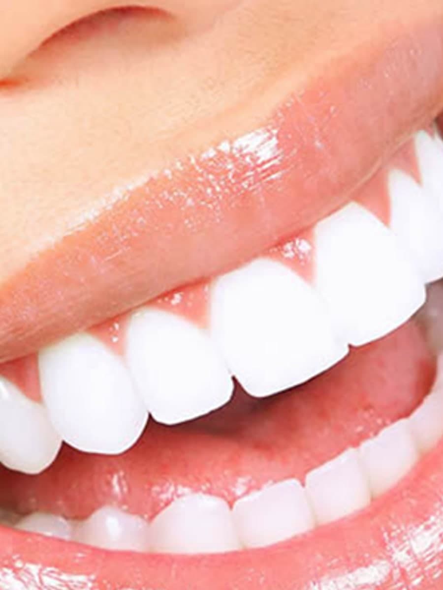 Zirkonyum restorasyonların renk uyumunun değerlendirildiği klinik ortam