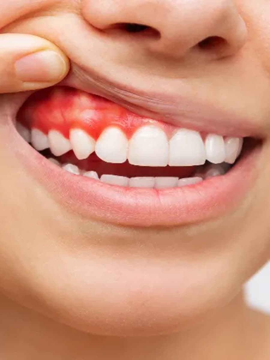 Diş eti sağlığı muayenesi yapılan klinik ortam